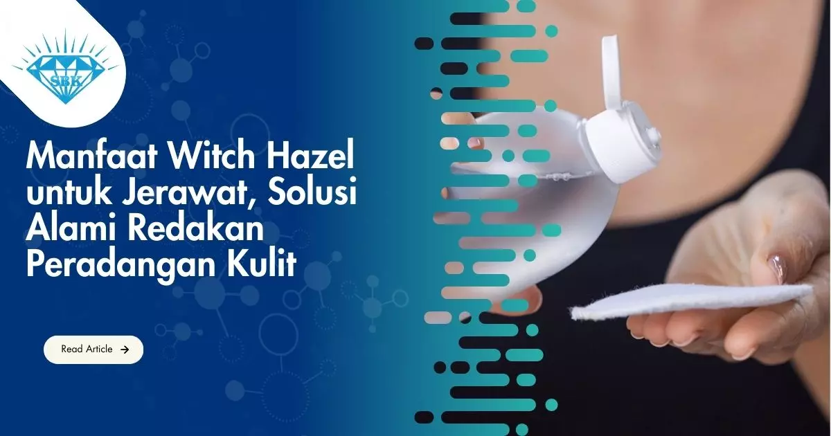 Manfaat Witch Hazel untuk Jerawat, Solusi Alami Redakan Peradangan Kulit Manfaat Witch Hazel untuk Jerawat, Solusi Alami Redakan Peradangan Kulit